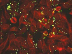 Ureaplasma parvum monoclonal antibodies