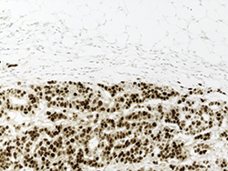 ISO 15189 assessment: a positive experience for immunohistochemistry