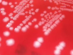 Identifying antibiotic-resistant Gram-negative bacteria