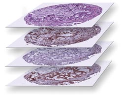 Digital pathology solution for tissue microarray analysis and research