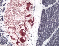 First impression and final impact in cellular pathology