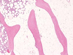 Sectioning bone: review of a special histology specimen