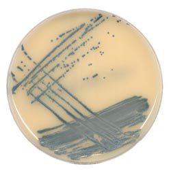 Methicillin-resistantS. aureus screening shows its true colours