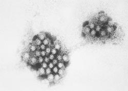 Rapid immunoassay diagnosis of norovirus gastroenteritis