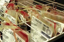 Transfusion practice: prescription for change