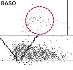 Cytogram interpretation: the new morphology in haematology?