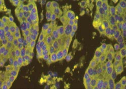 Fully automated HER2 fluorescence in situ hybridisation: successful introduction on a staining platform