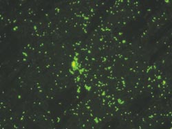 Listeria monoclonal antibodies