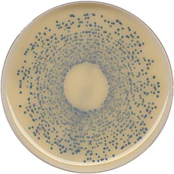 Methicillin-resistant Staphylococcus aureus: a rapid method for effective screening