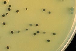 C. perfringens enumeration and identification