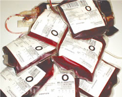 Real solutions produce real benefits in transfusion