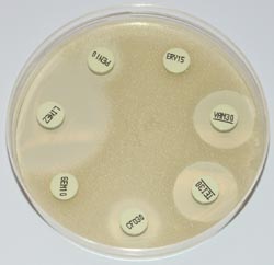 Comparative study of antibiotic-impregnated discs and tablets