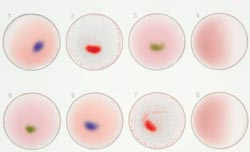 Latex agglutination tests in microbiology