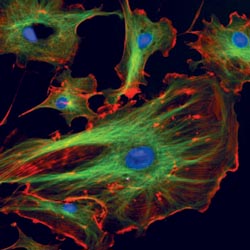 Fluorescence microscopy in the pathology laboratory