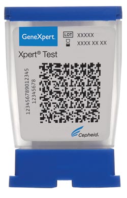 In vitro molecular diagnostic test for CT/NG