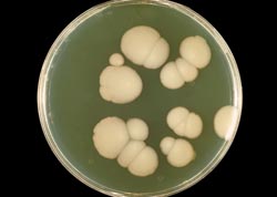 Micafungin added to fungal susceptibility card