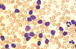 Single-step surface and intracellular staining without centrifugation