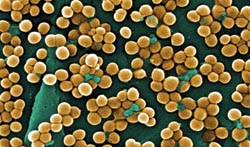 Evaluation of two swab types in the rapid detection of MRSA using a PCR analyser