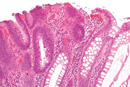 Faecal immunochemical testing