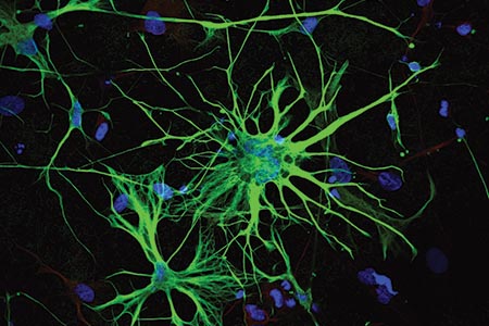 Stem cells in neuroscience research