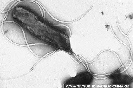 Automated H. pylori antigen detection