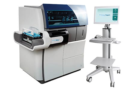 Viscosity-based detection: addressing HIL interference and sample integrity