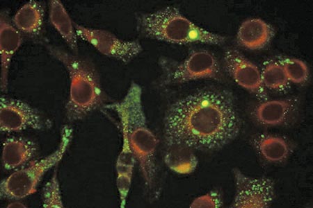 Chlamydia pneumoniae monoclonal antibodies