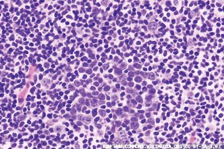 Targeting diffuse large B‐cell lymphoma