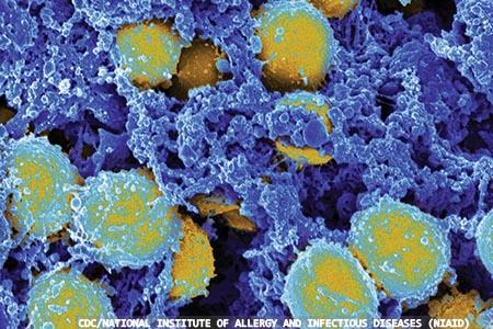Reducing methicillin-resistant  Staphylococcus aureus  with chlorine dioxide