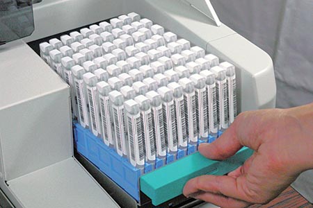 A FIT approach: improving  sample integrity for faecal  haemoglobin testing