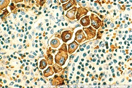 Improved techniques  and technology for cellular  and molecular pathology