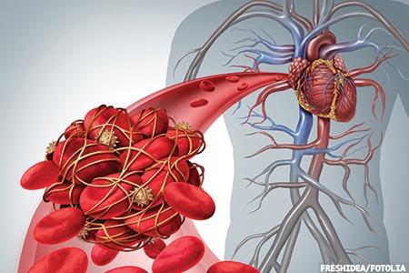 Providing confidence when measuring blood levels of the new direct oral anticoagulants 