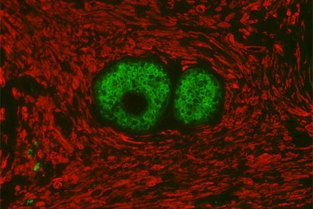 Double staining streamlines Immunofluorescence Workflow