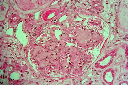 Kidney research using a single-cell RNA-Seq system 