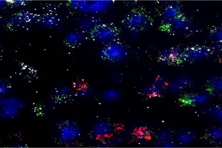 Rapid, easy and accurate gene expression detection and localisation