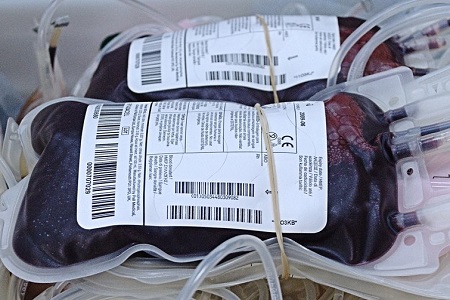 Gene editing to improve red cell transfusion compatibility