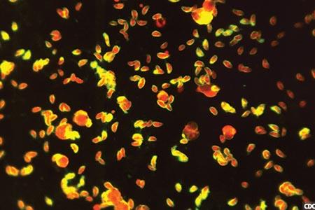 Loop-mediated isothermal amplification: diagnostics closer to the patient