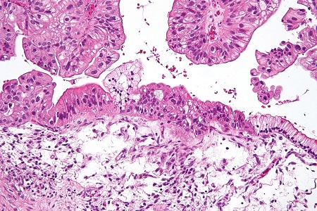 Demand for histopathology in focus