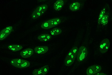 Immunofluorescence applications enhanced by anti-fade mountant 