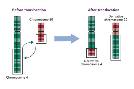 Chromosome analysis: from karyotyping to microarray analysis