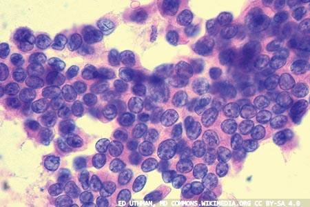 Non-gynaecological cytopathology: a look in the current literature