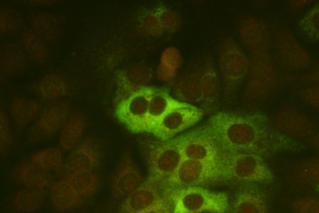 Monoclonal antibodies to coronaviruses