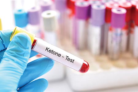 Overcoming challenges in ketone testing: from diabetes to sepsis