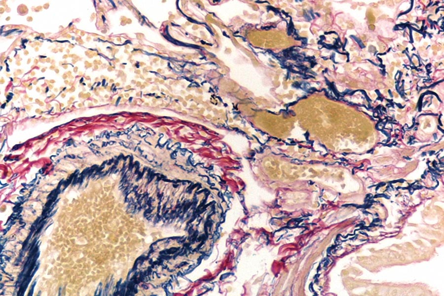 Cellular pathology  technique: evolution of  a UK NEQAS scheme