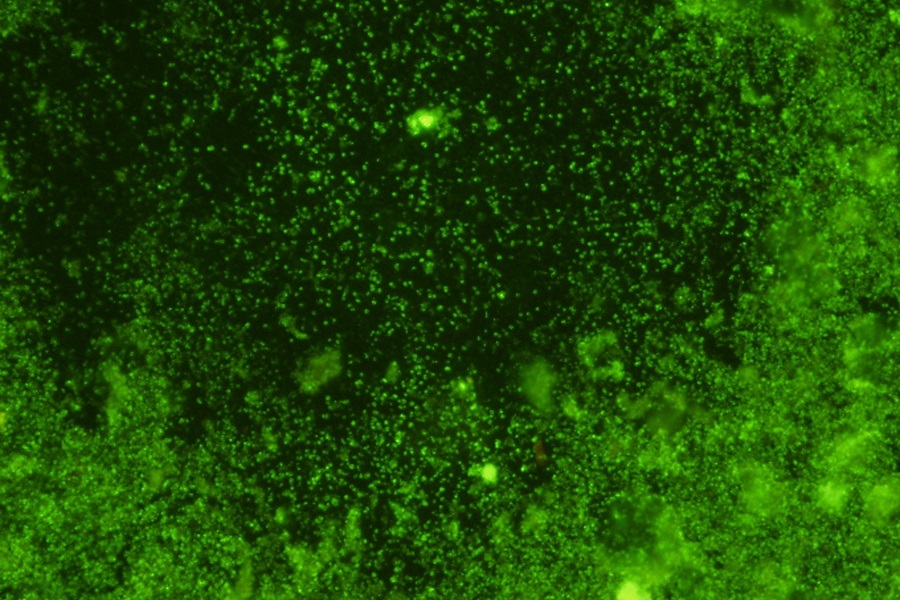 detection-of-gram-positive-bacteria