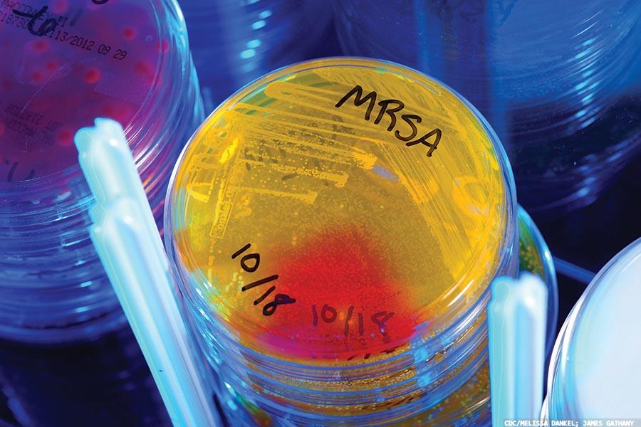 Point-of-care MRSA tests of trauma patients offer trust-wide benefits