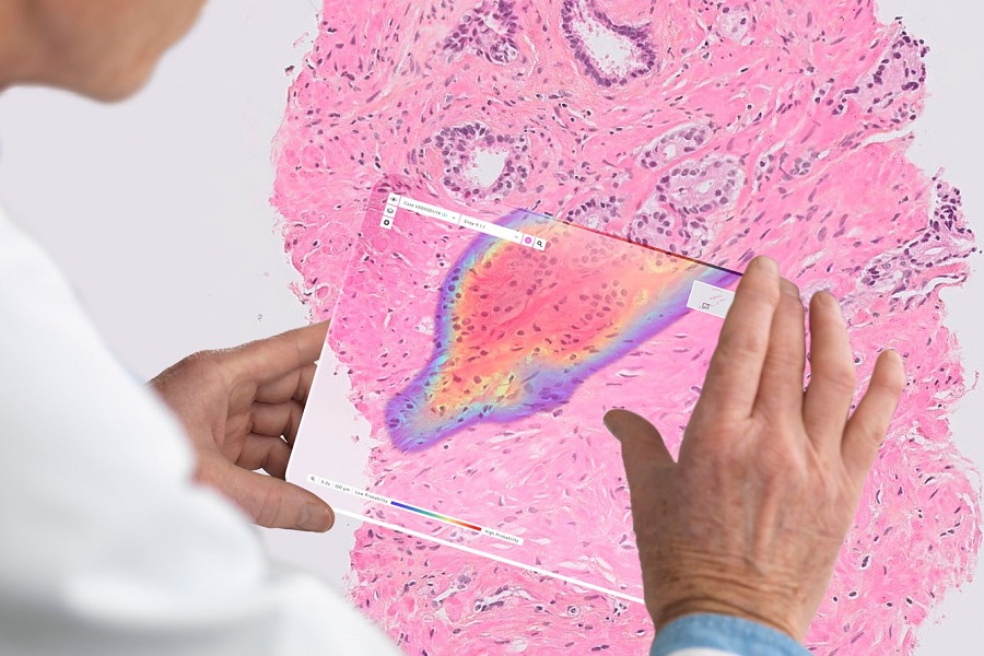 Collaboration to develop AIbased digital pathology applications