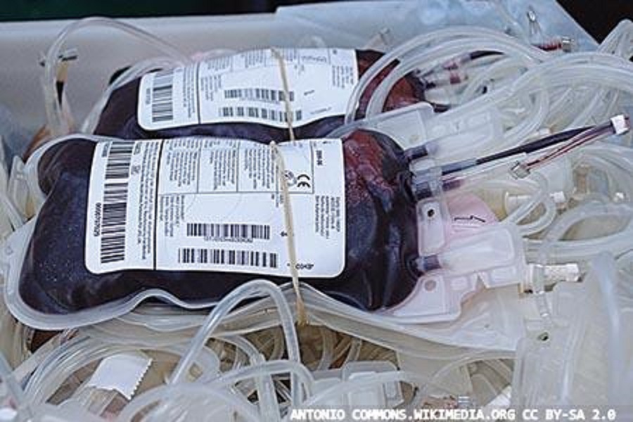 National Comparative Audits of Blood Transfusion: a highlight reminder