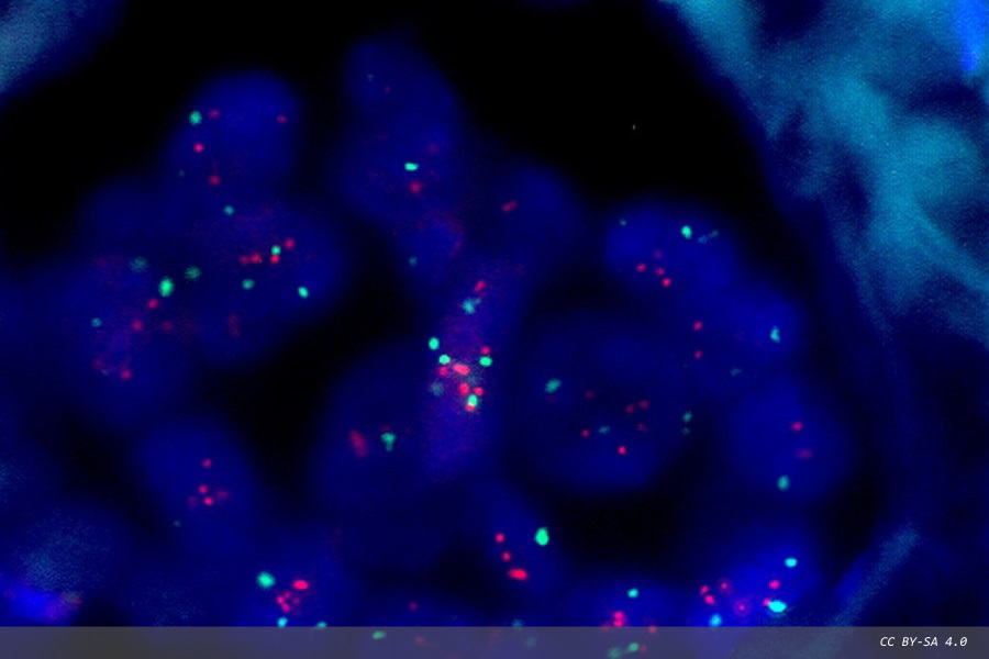 Bio-Rad launches anti-pertuzumab antibodies