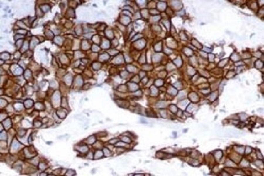 Delivering AI-powered pathology to drive insight in cancer diagnosis 